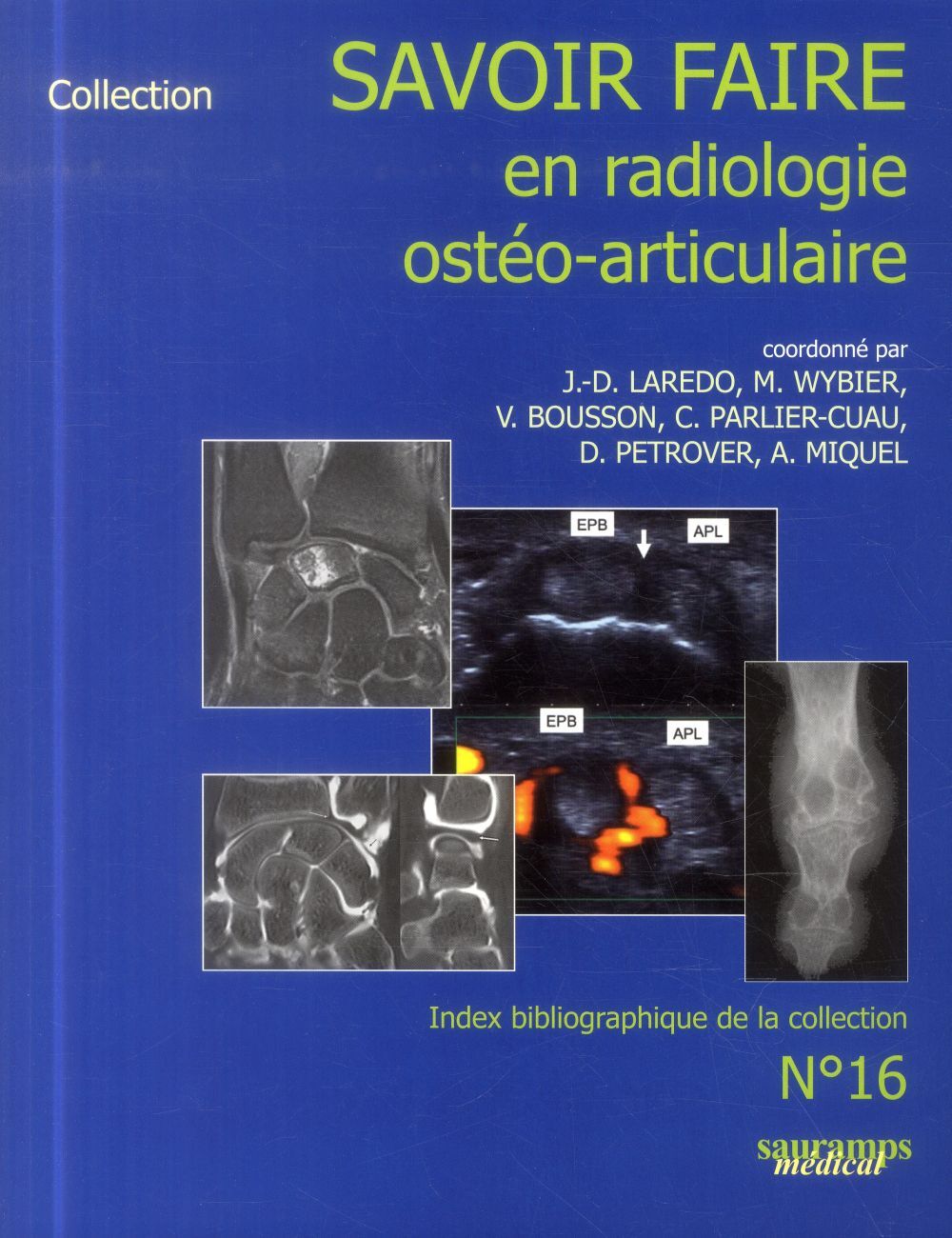 SAVOIR-FAIRE EN RADIOLOGIE OSTEO-ARTICULAIRE N 16