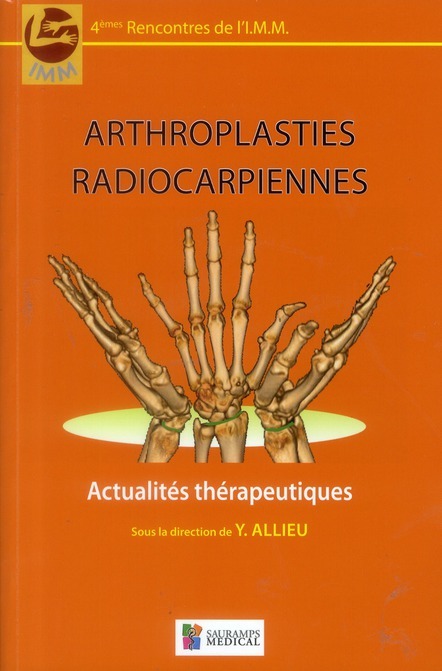 ARTHROPLASTIES RADIOCARPIENNES