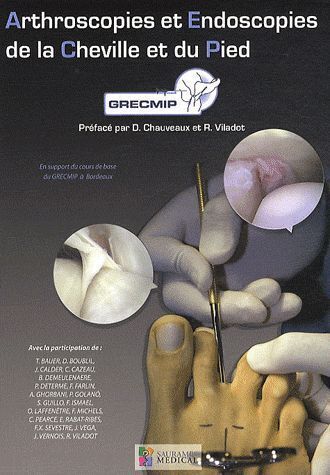 ARTHROSCOPIES ET ENDOSCOPIES DE LA CHEVILLE ET DU PIED
