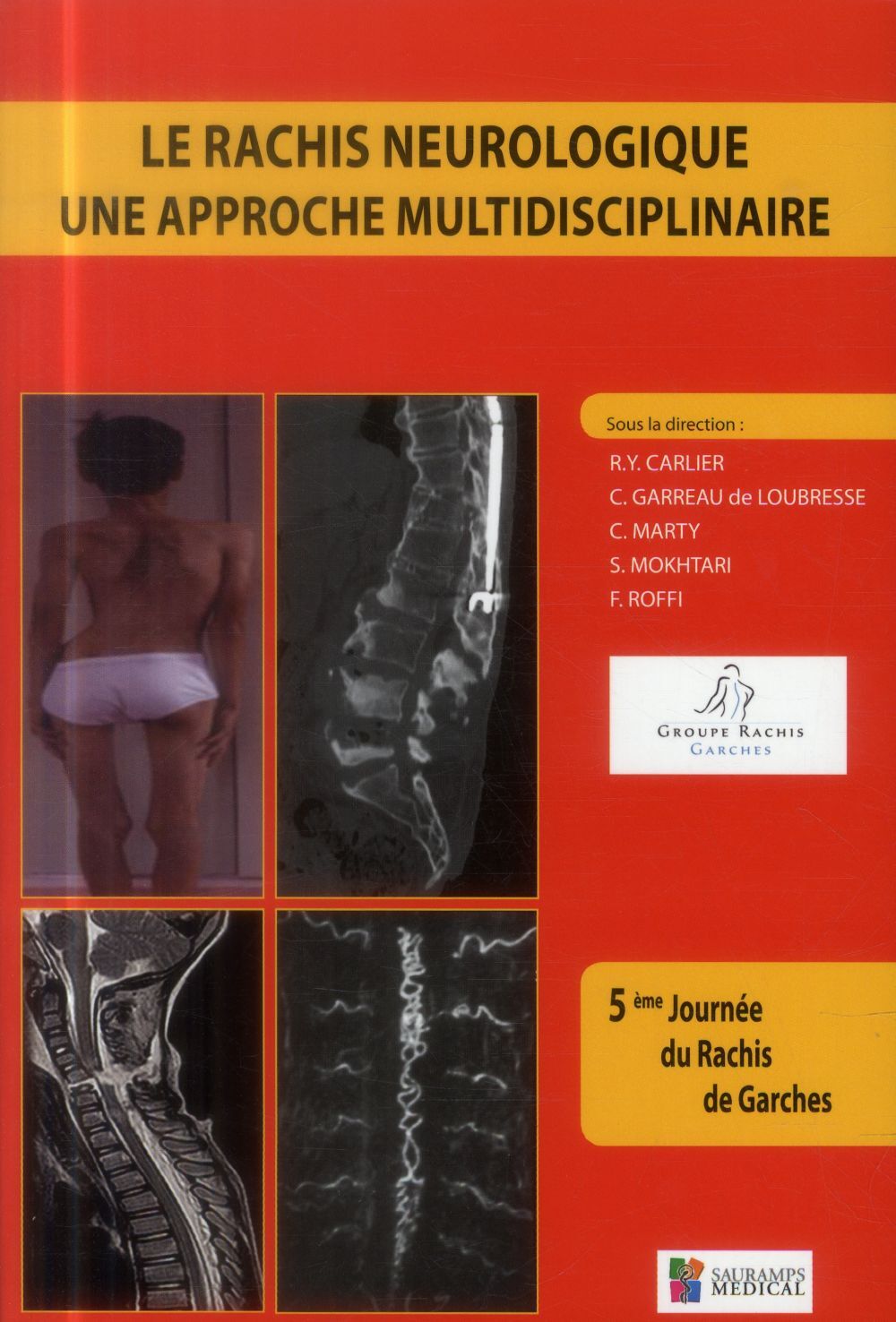 LE RACHIS NEUROLOGIQUE