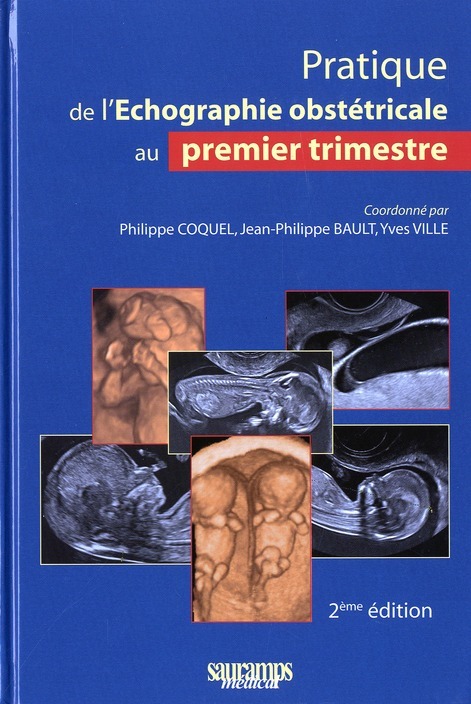 PRATIQUE ECHOGRAPHIE OBSTETRICALE 1ER TRIMESTRE 2EME EDITION