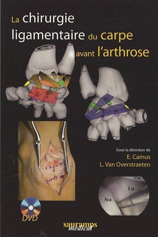 LA CHIRURGIE LIGAMENTAIRE DU CARPE AVEC DVD