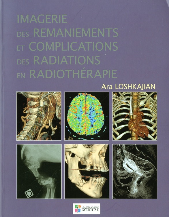 IMAGERIE DES RAMANIEMENTS ET COMPLICATIONS DES RADIATIONS EN RADIOTHERAPIE