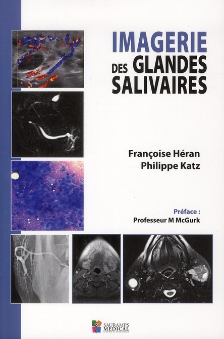 IMAGERIE DES GLANDES SALIVAIRES