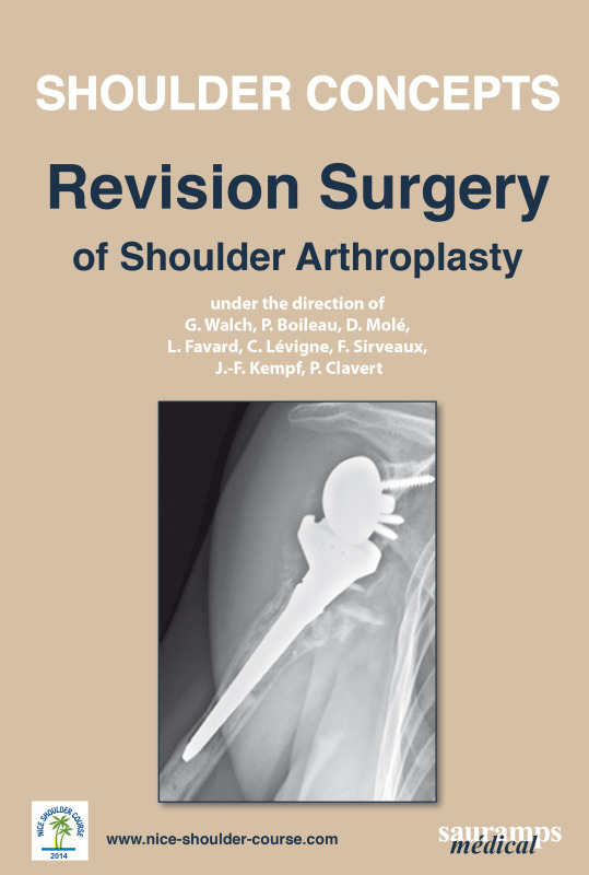 SHOULDER CONCEPTS - REVISION SURGERY OF SHOULDER ARTHROPLASTY 2014