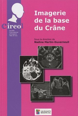 IMAGERIE DE LA BASE DU CRANE
