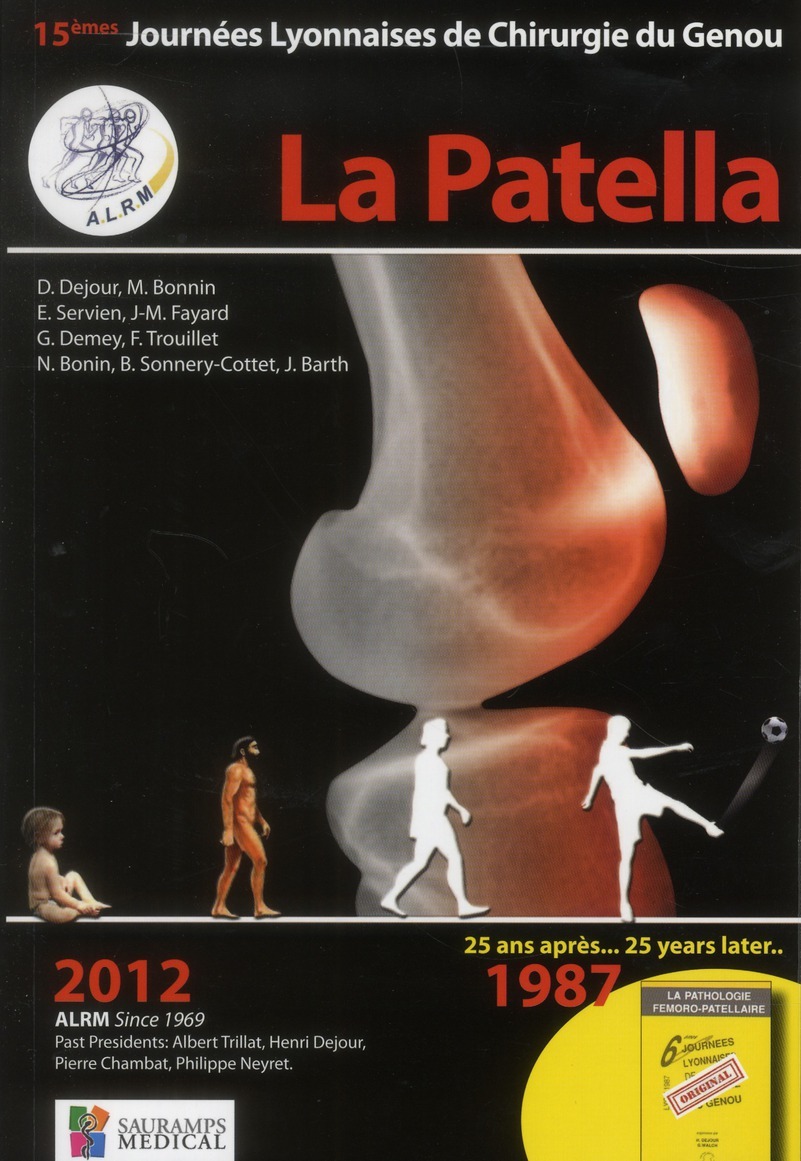 LA PATELLA - ALRM