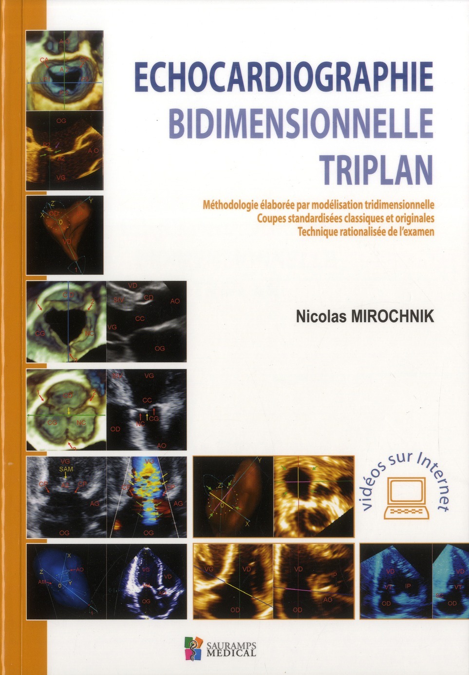 ECHOCARDIOGRAPHIE BIDIMENTIONNELLE TRIPLAN
