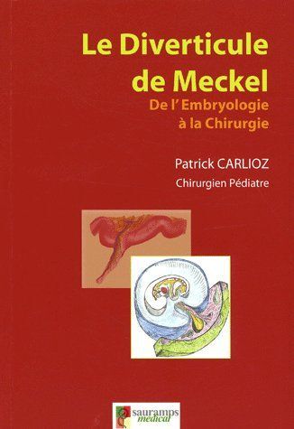 LE DIVERTICULE DE MECKEL