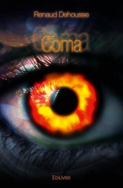 Coma