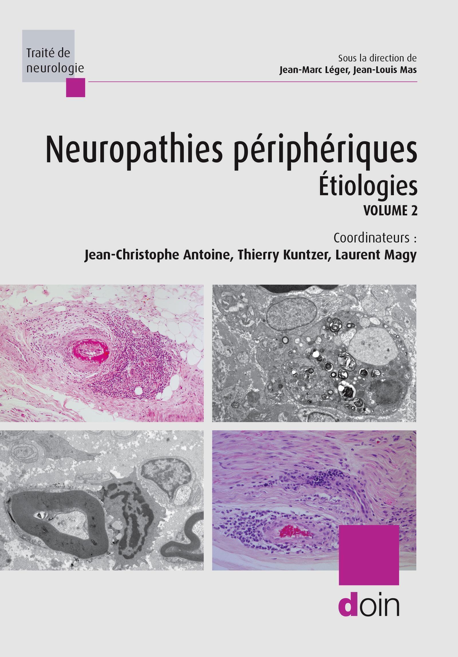 Neuropathies périphériques. Volume 2 : Etiologies