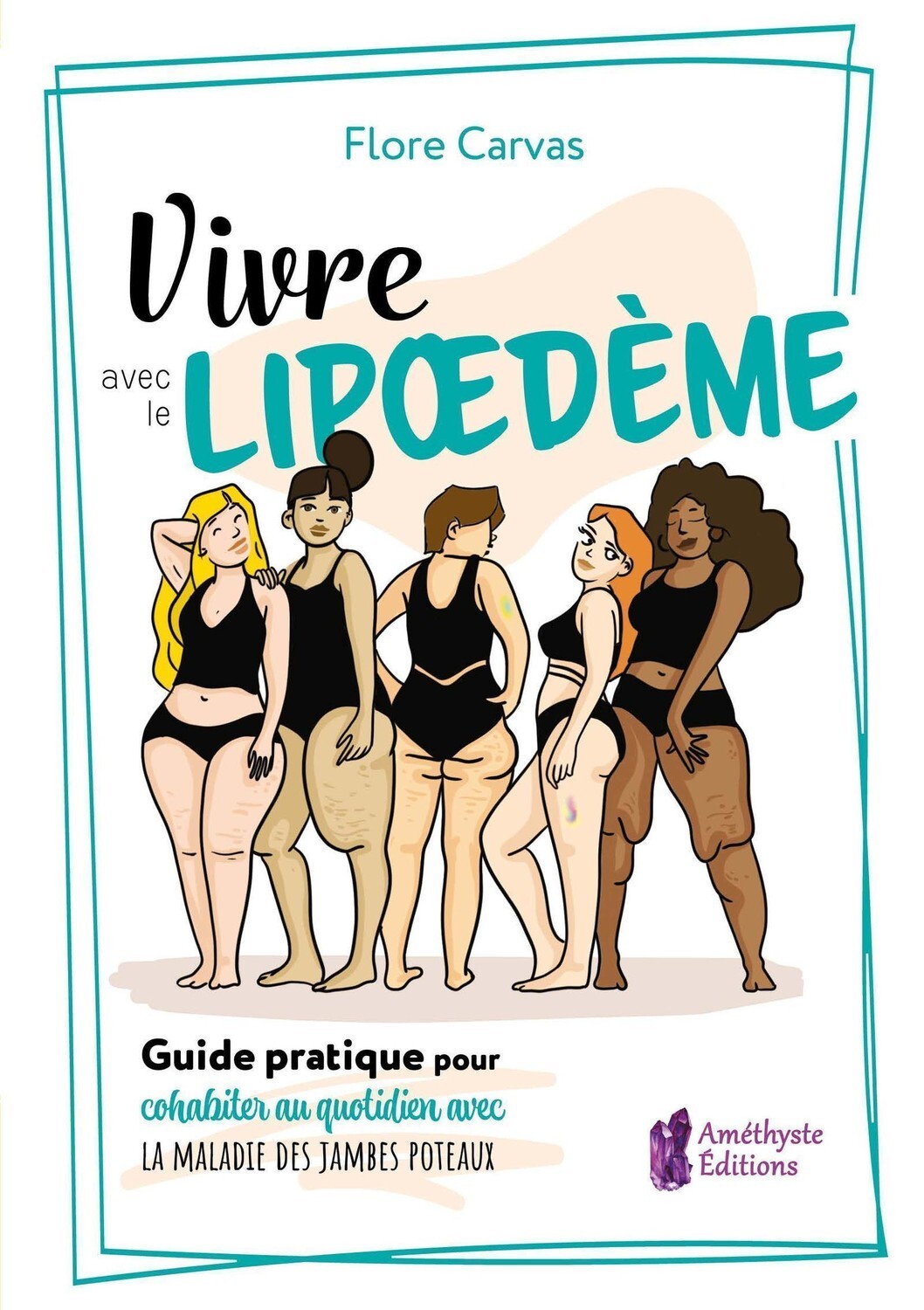 Vivre avec le Lipoedème - Guide pratique pour cohabiter avec la maladie des jambes poteaux