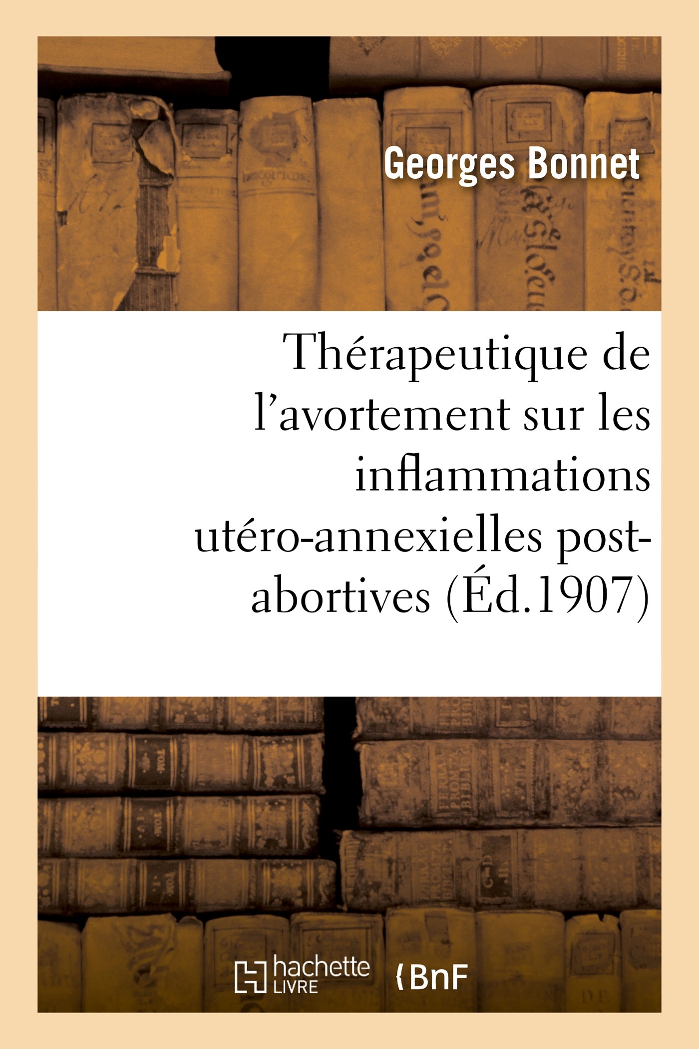 Influence de la thérapeutique de l'avortement sur les inflammations utéro-annexielles post-abortives