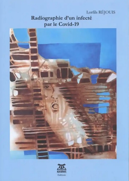 Radiographie d'un infecté par le Covid-19