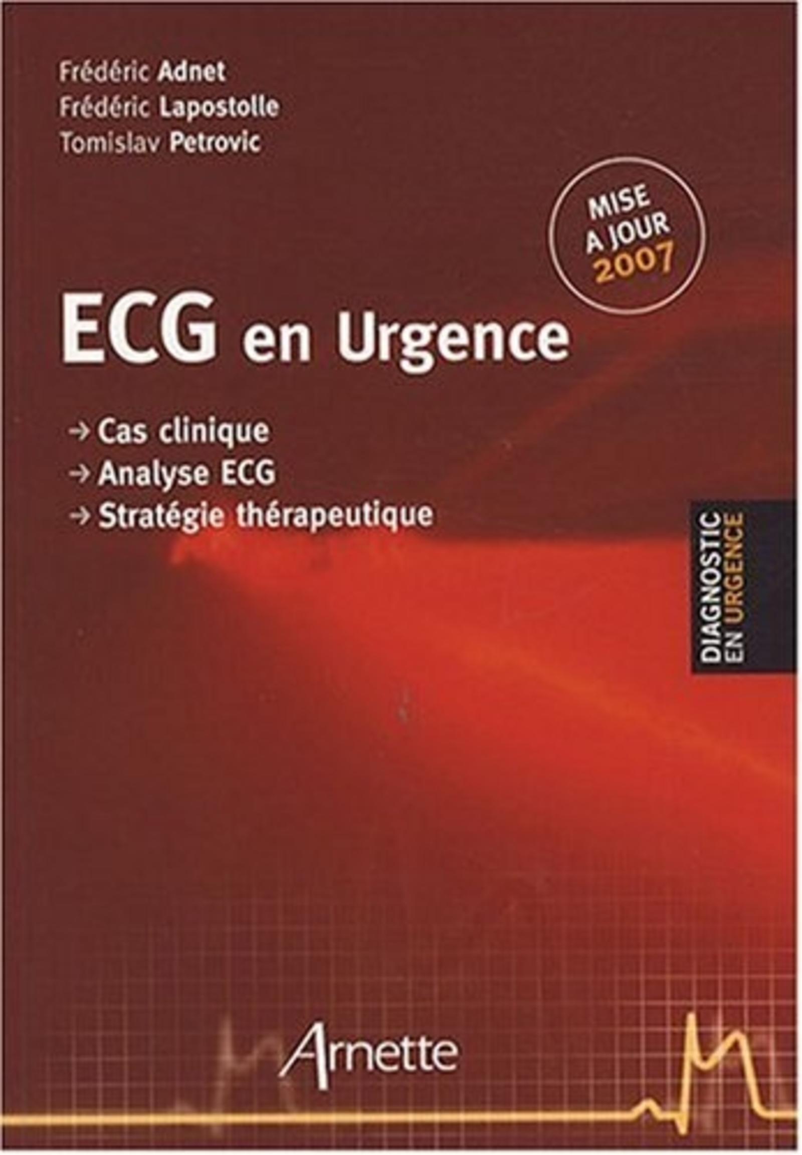 ECG EN URGENCE 3EME EDITION