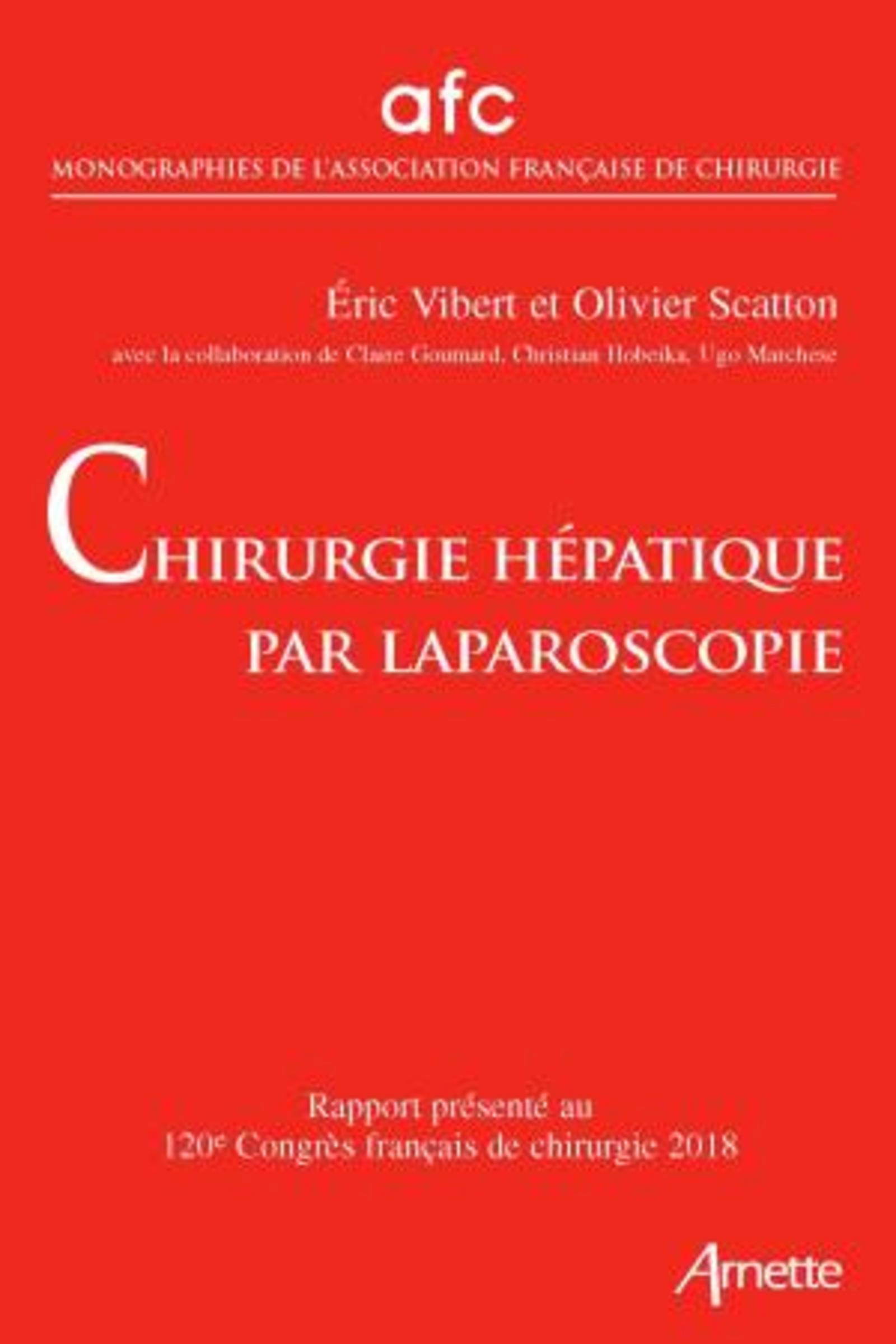 Chirurgie hépatique par laparoscopie