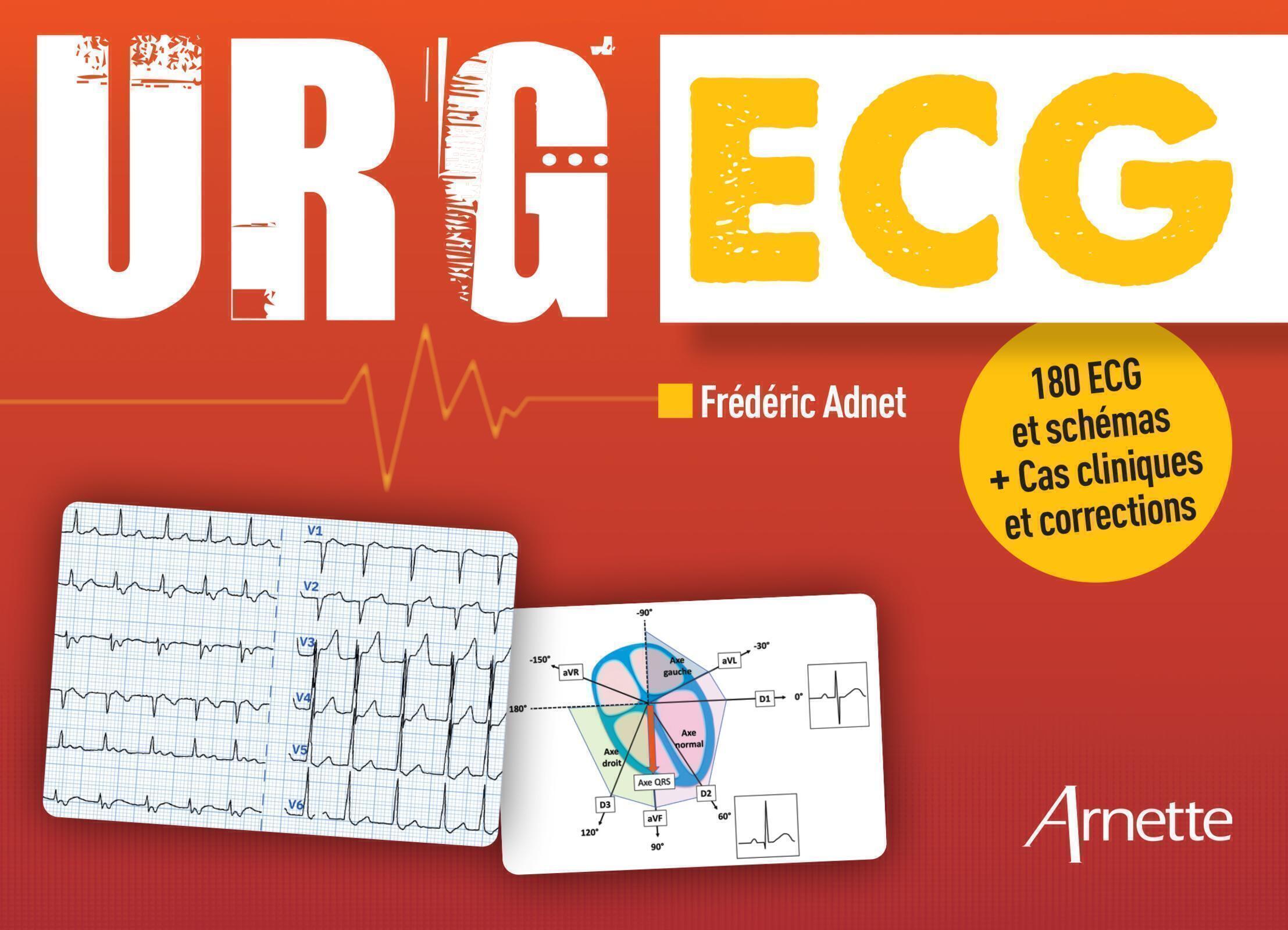 URG' ECG
