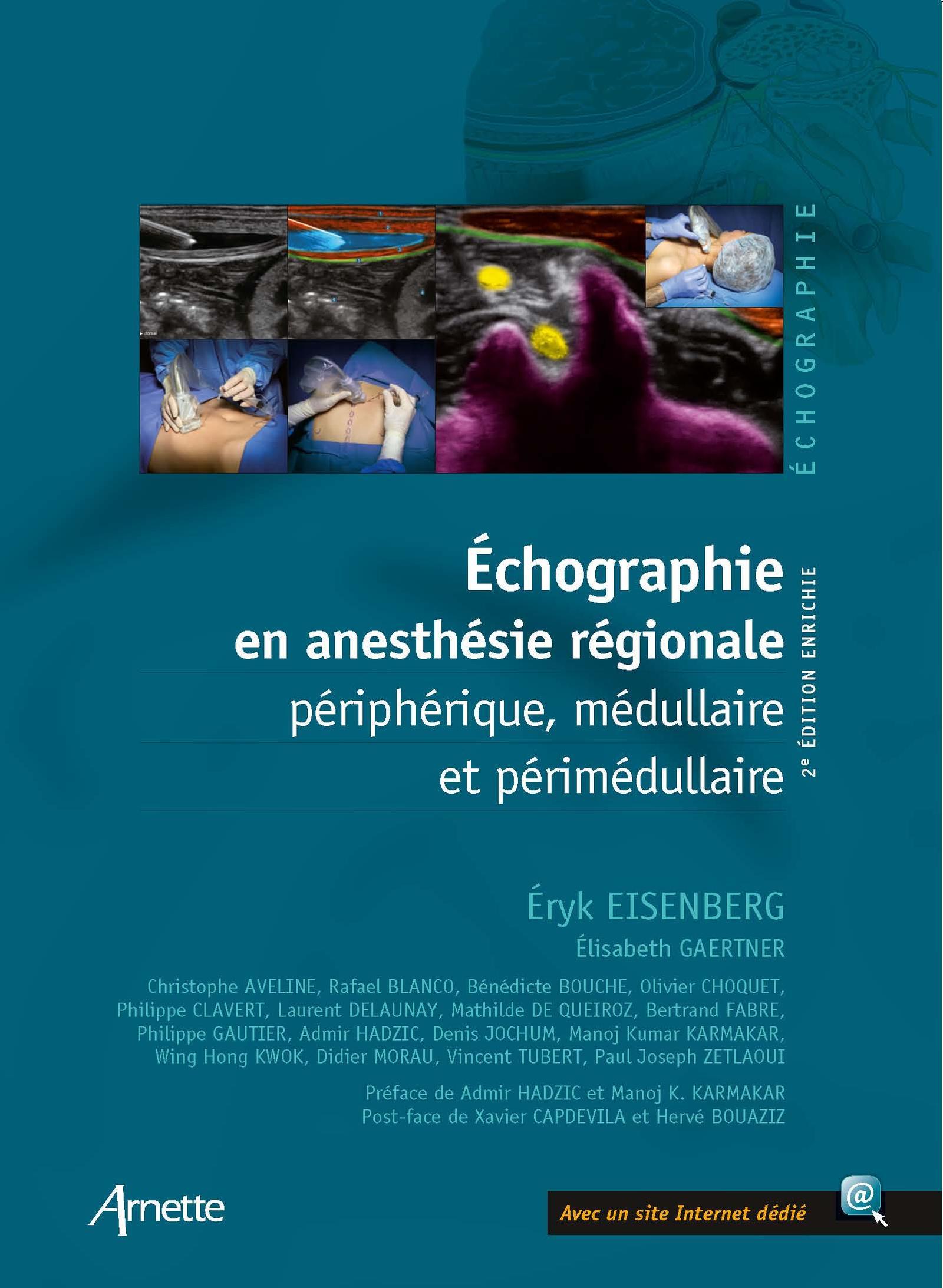 ECHOGRAPHIE EN ANESTHESIE REGIONALE PERIPHERIQUE MEDULLAIRE ET PERIMEDULLAIRE 2E