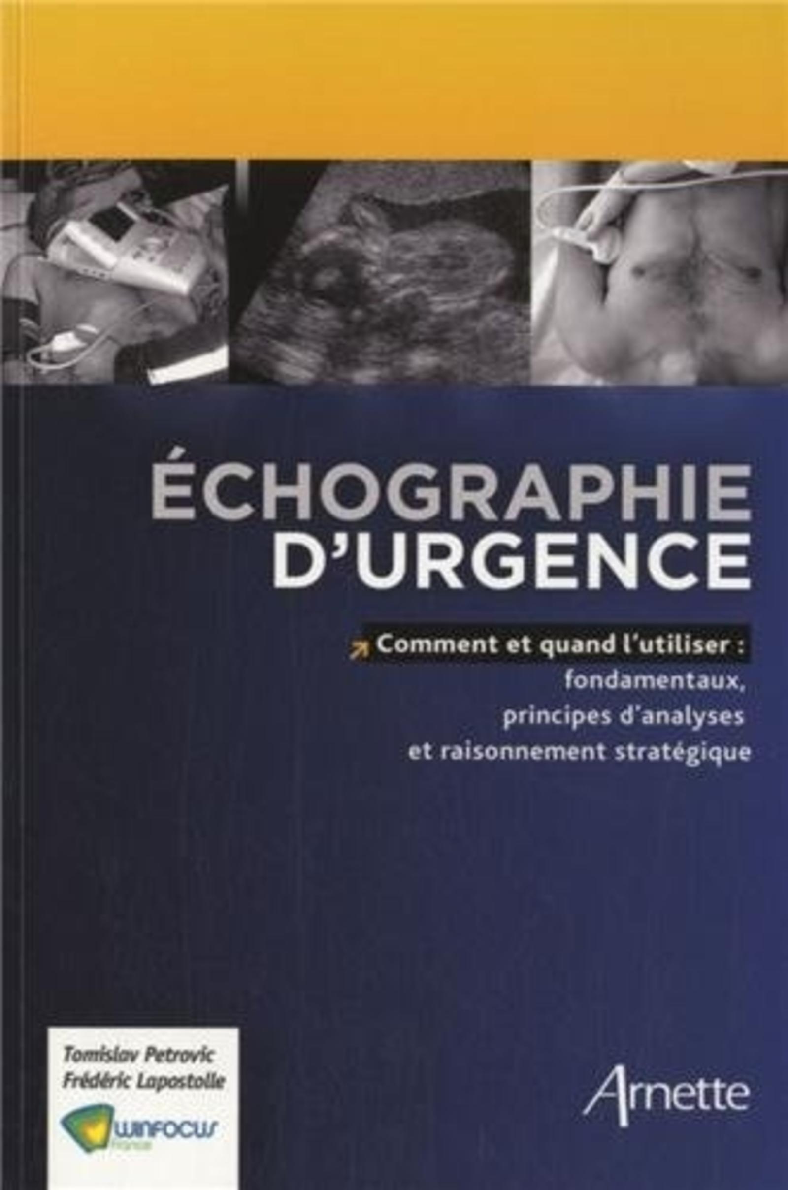 ECHOGRAPHIE D URGENCE