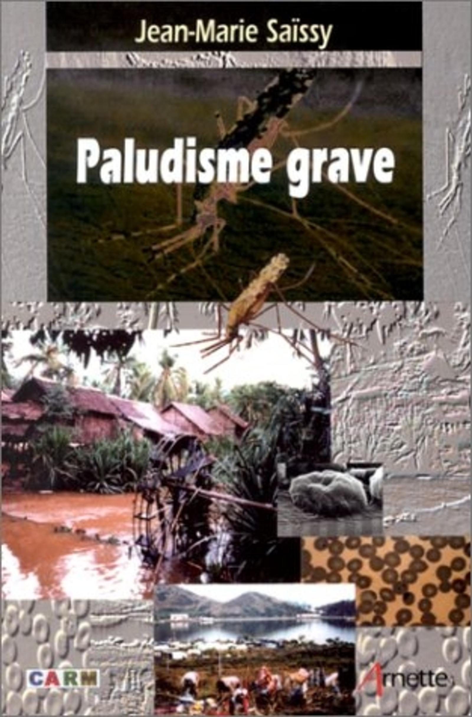 PALUDISME GRAVE