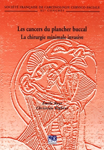 CANCERS DU PLANCHER BUCCAL (LES)
