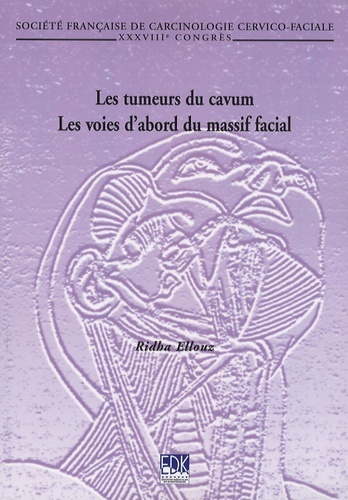 TUMEURS DU CAVUM ( LES) - LES VOIES D'ABORD DU MASSIF FACIAL