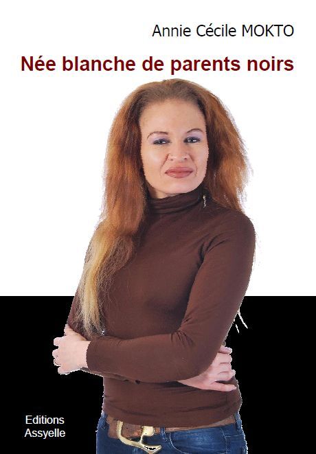 Née blanche de parents noirs