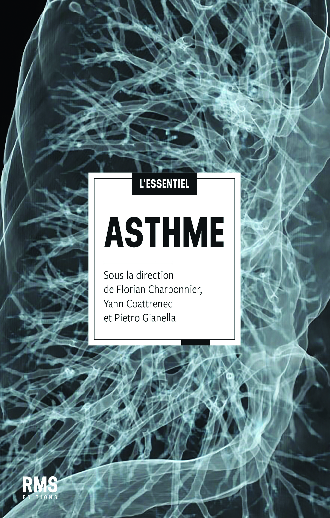 ASTHME : L'ESSENTIEL