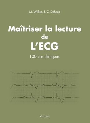Maitriser la lecture de l'ecg