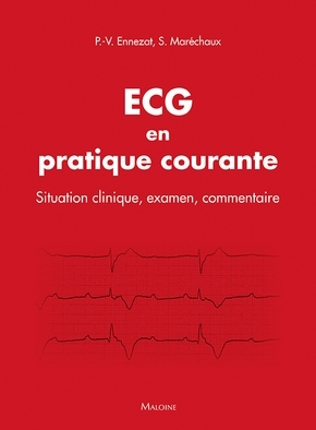 ECG en pratique courante - situation clinique, interprétation, décision