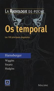 RADIOLOGIE DE POCHE - OS TEMPORAL. LES 100 PRINCIPAUX DIAGNOSTICS