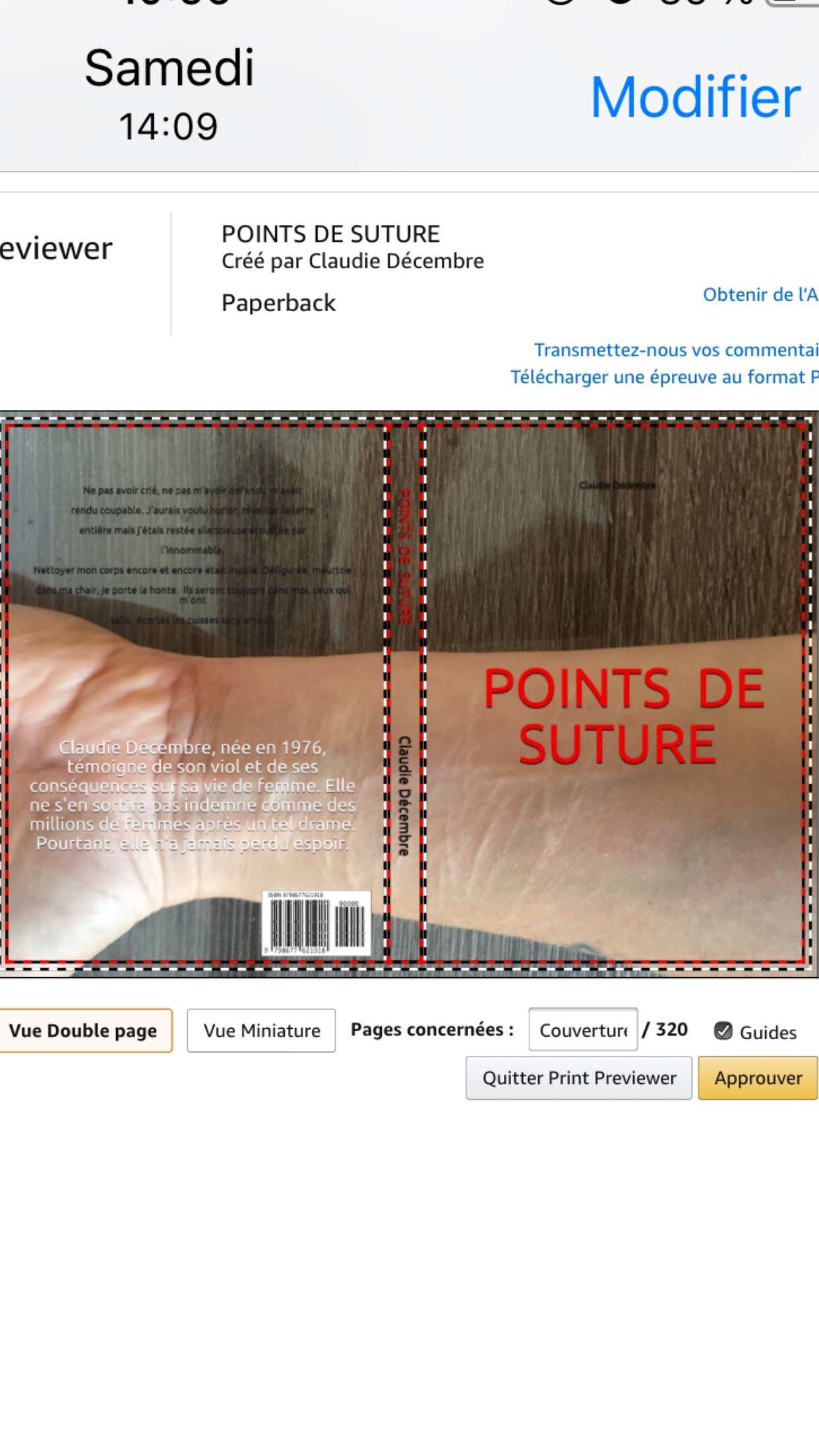Points de suture