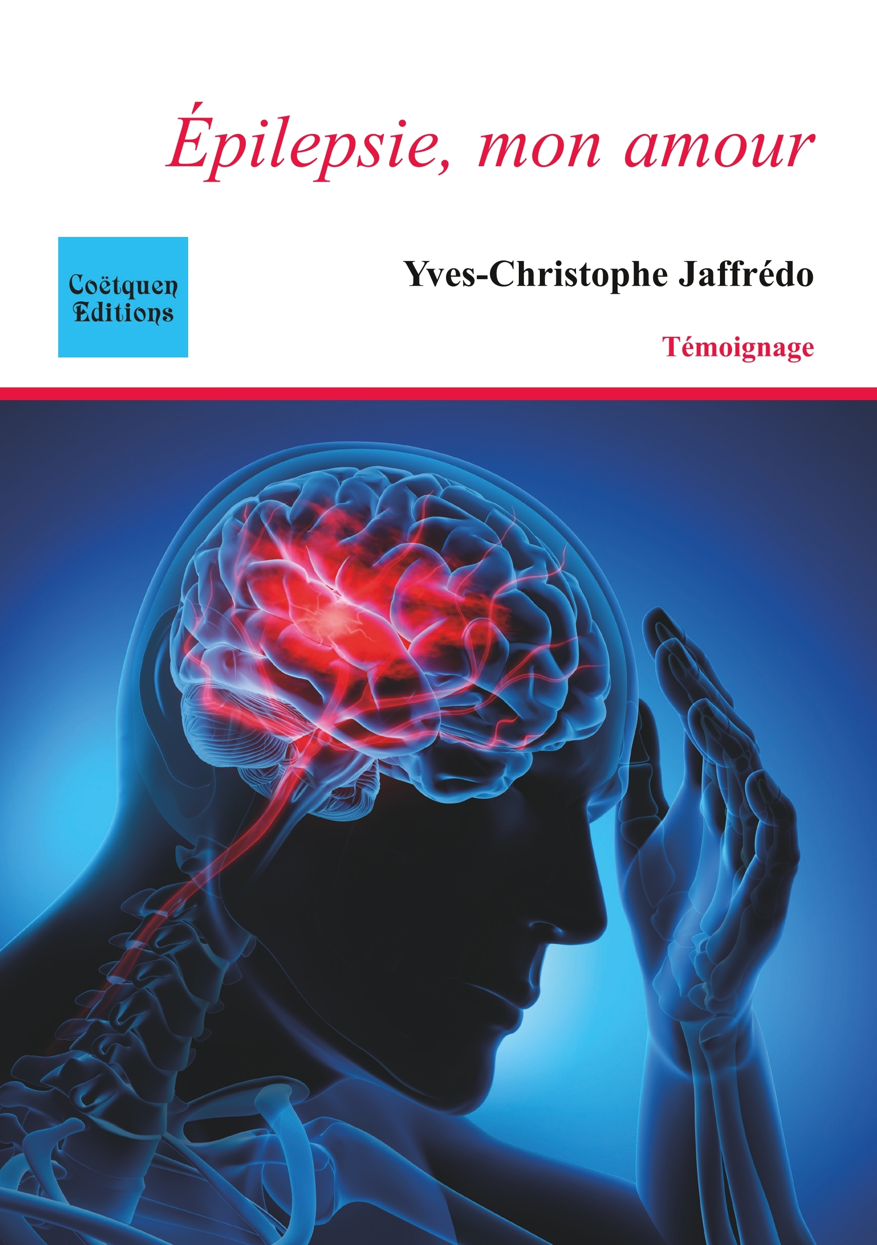 Epilepsie, mon amour