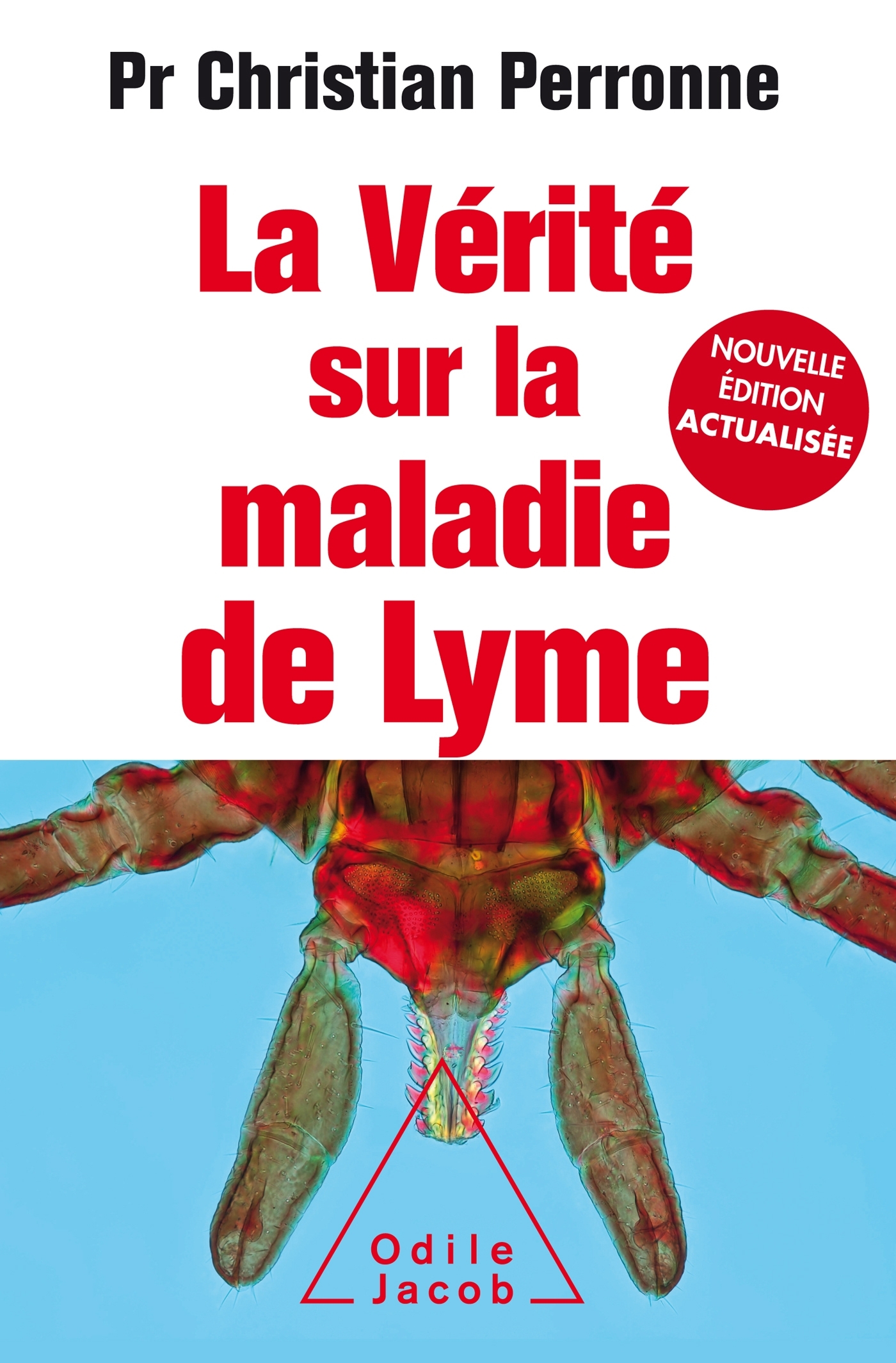 La Vérité sur  la maladie de Lyme -NE Augmentée
