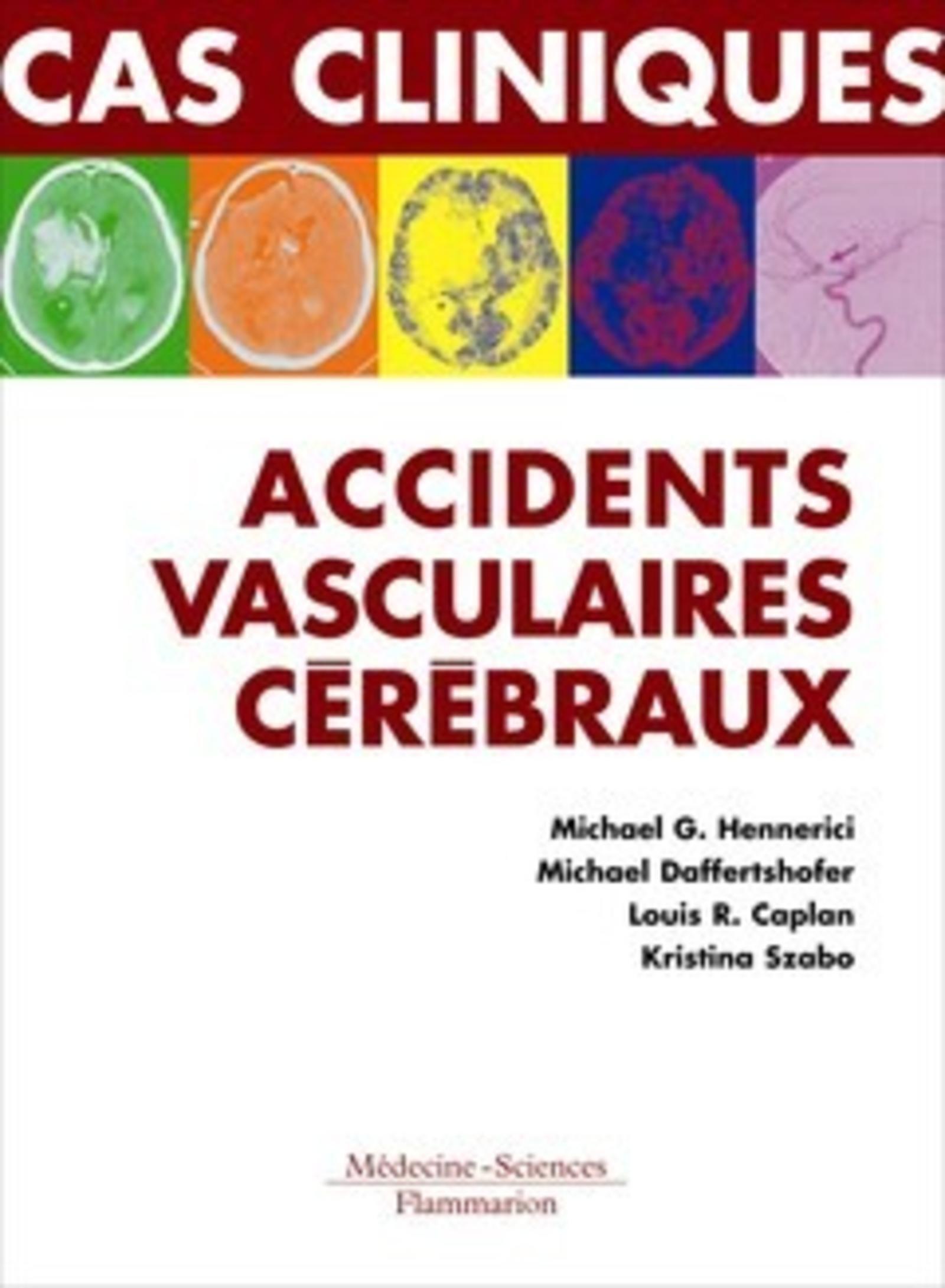 Accidents vasculaires cérébraux. Formes cliniques habituelles et inhabituelles