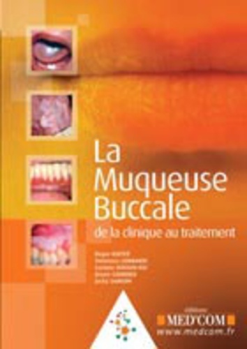 LA MUQUEUSE BUCCALE