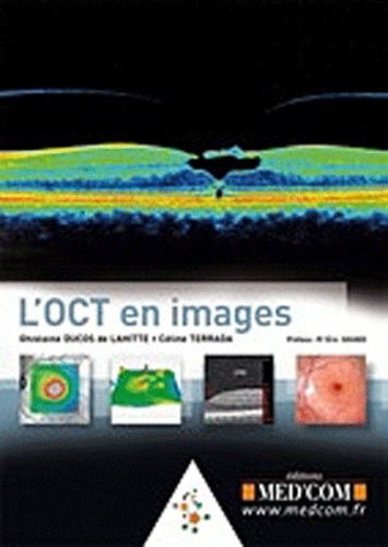 L'OCT EN IMAGES