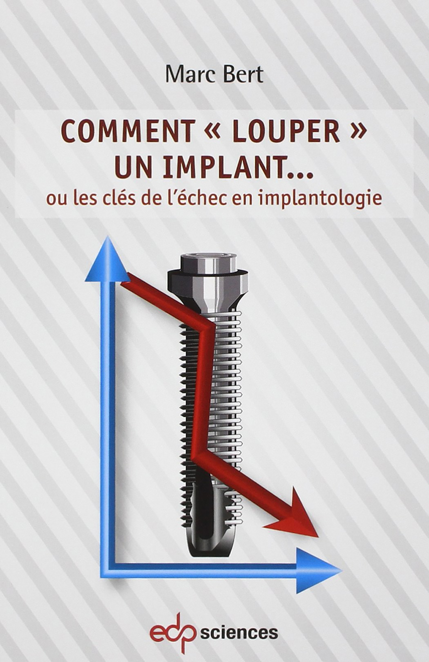 COMMENT LOUPER UN IMPLANT