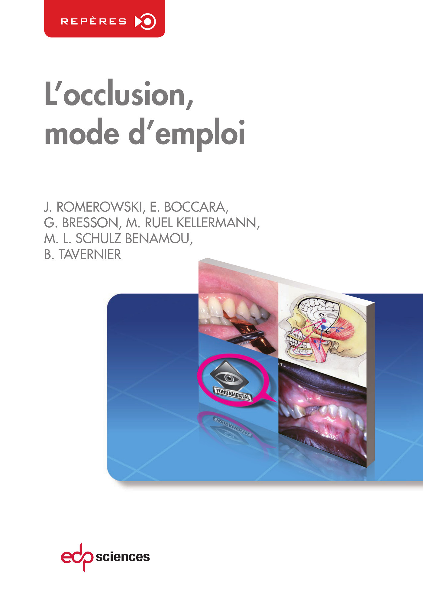 OCCLUSION, MODE D'EMPLOI (L')