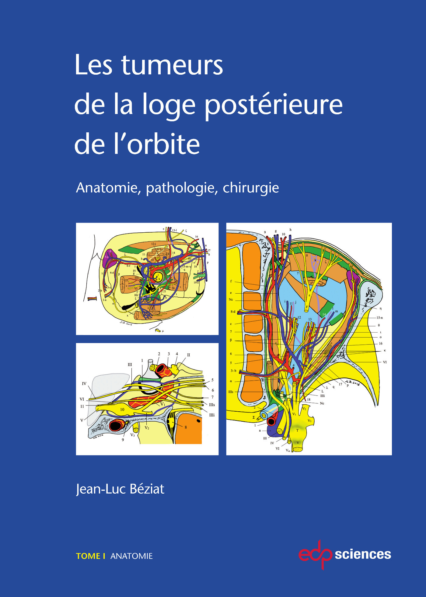TUMEURS DE LA LOGE POSTERIEURE DE L'ORBITE