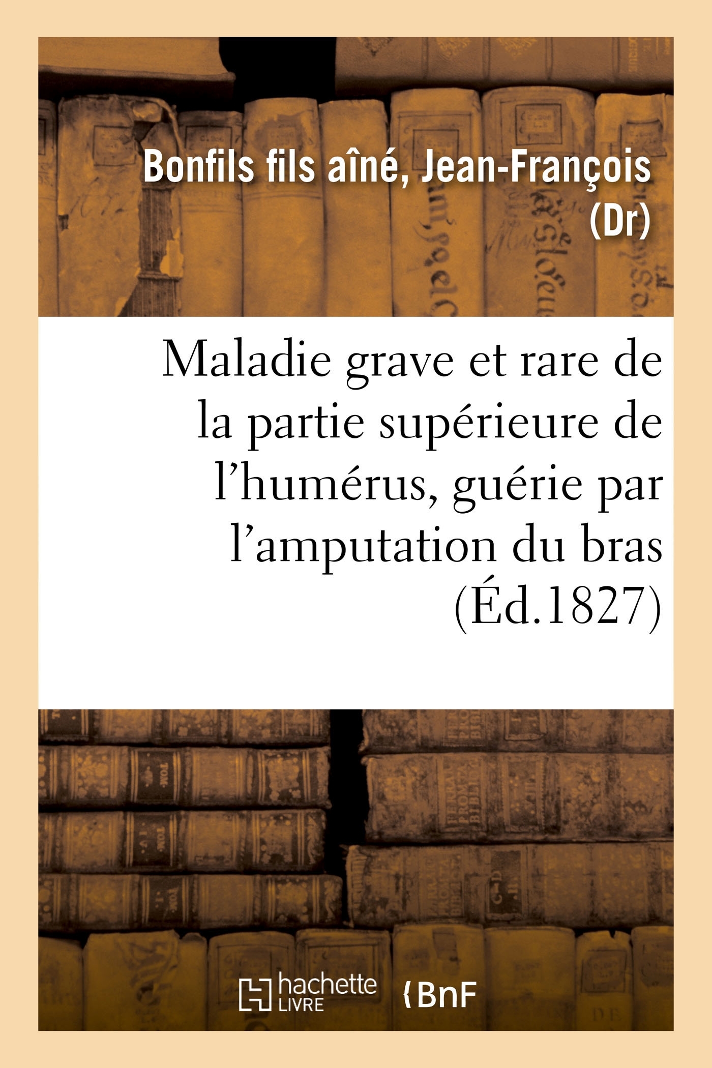 Description succincte d'une maladie grave et rare de la partie supérieure de l'humérus
