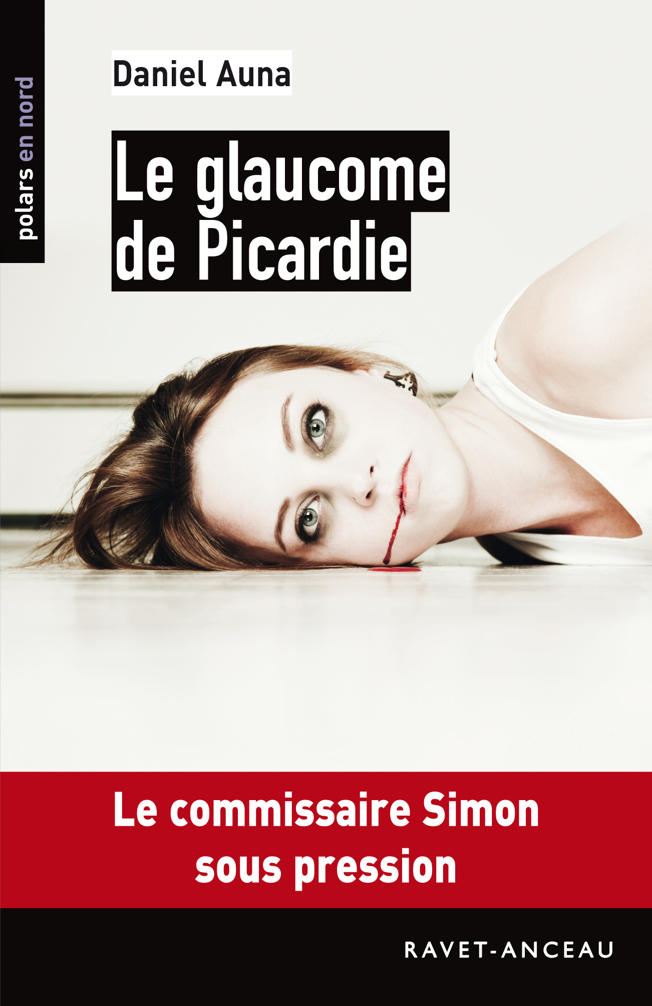 LE GLAUCOME DE PICARDIE