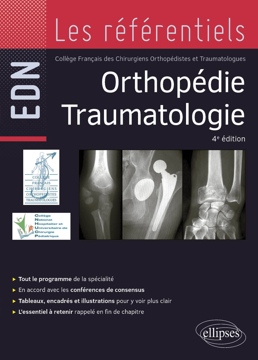 Orthopédie Traumatologie
