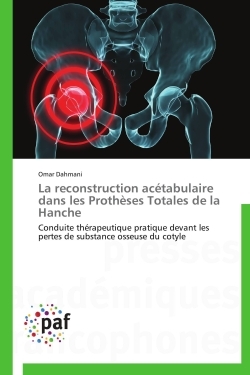 La reconstruction acétabulaire dans les prothèses totales de la hanche