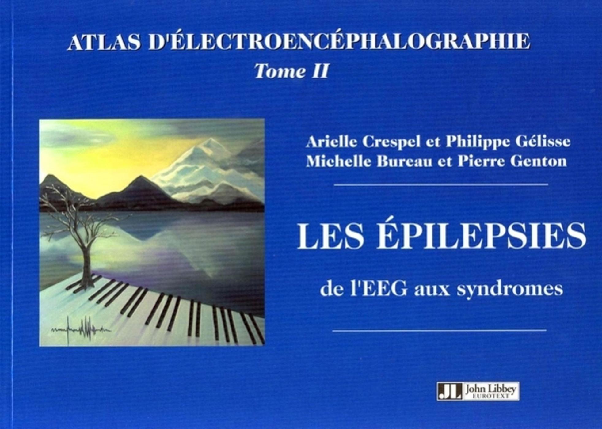 Les Epilepsies De L'Eeg Aux Syndromes. Atlas D'Electroencephalographie Tome Ii