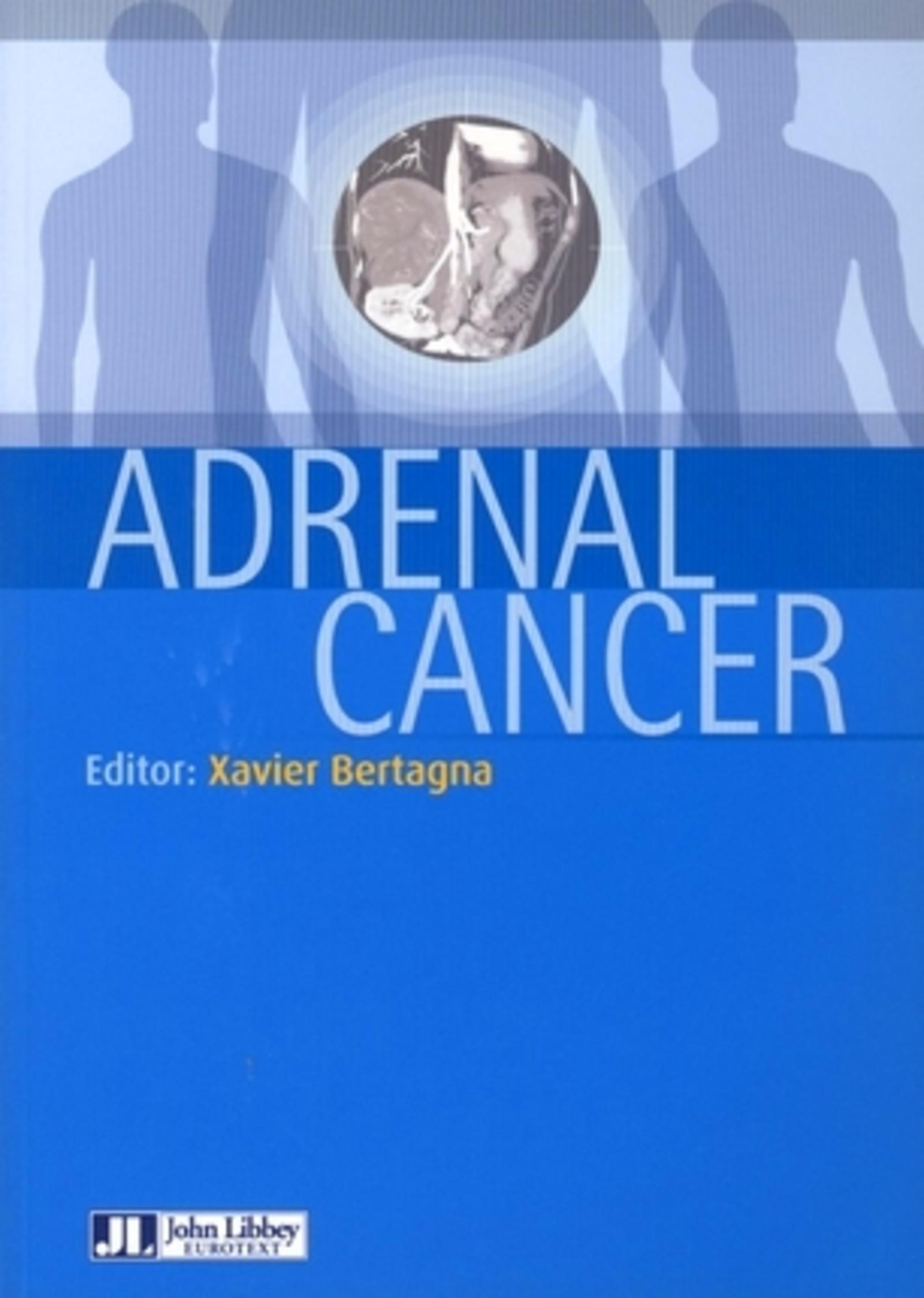 ADRENAL CANCER
