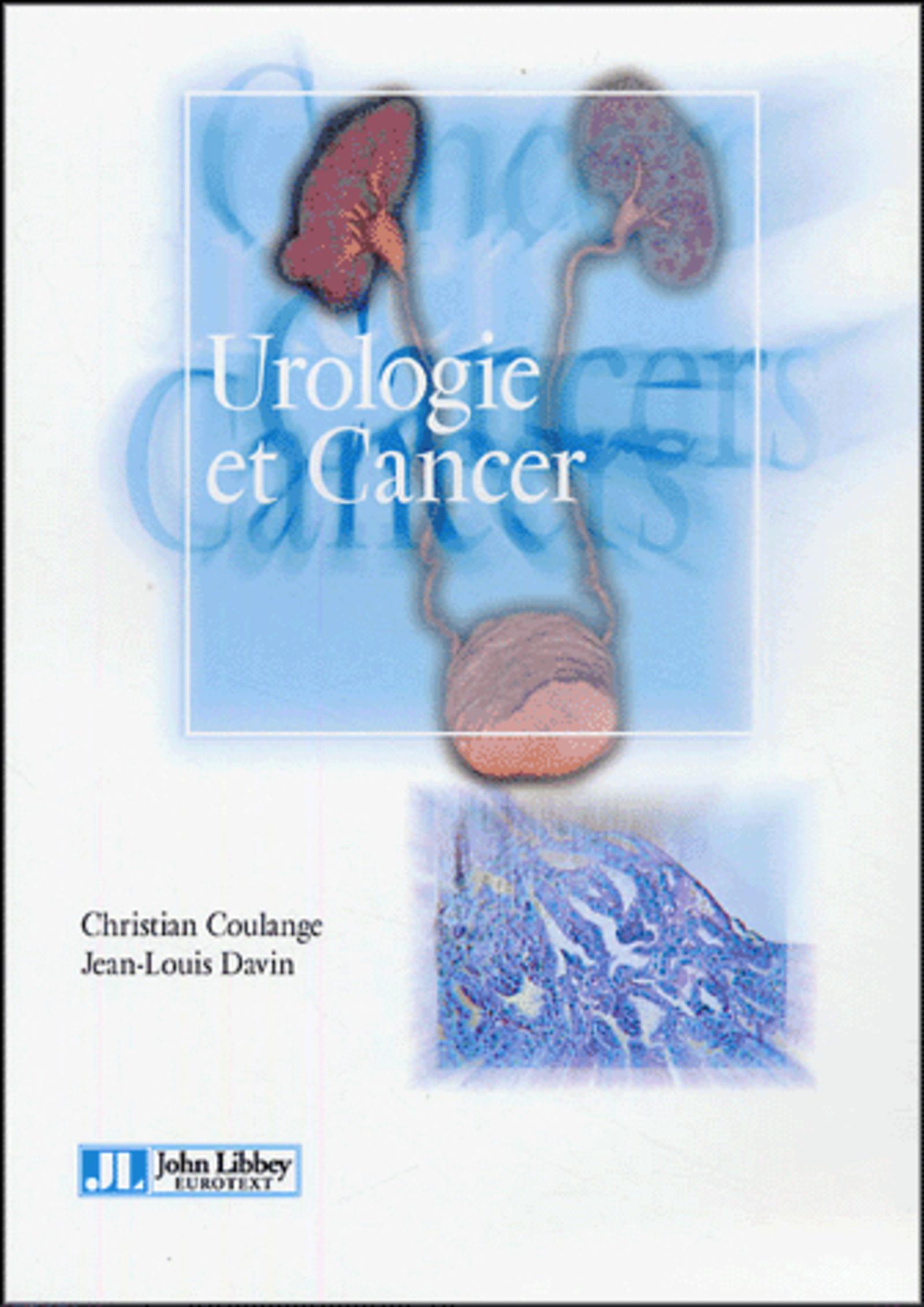UROLOGIE ET CANCER