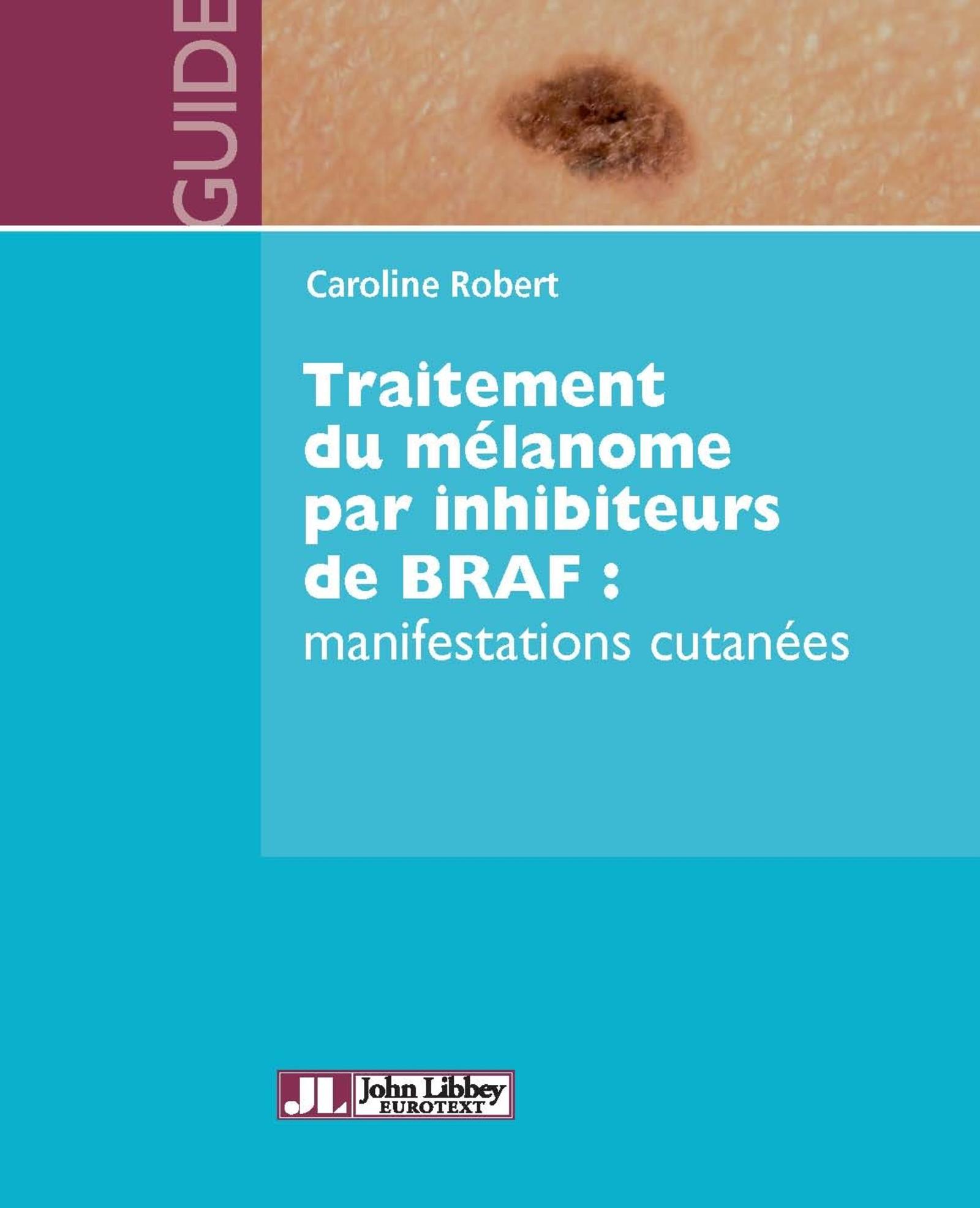 TRAITEMENT DU MELANOME PAR INHIBITEURS DE BRAF : MANIFESTATIONS CUTANEES