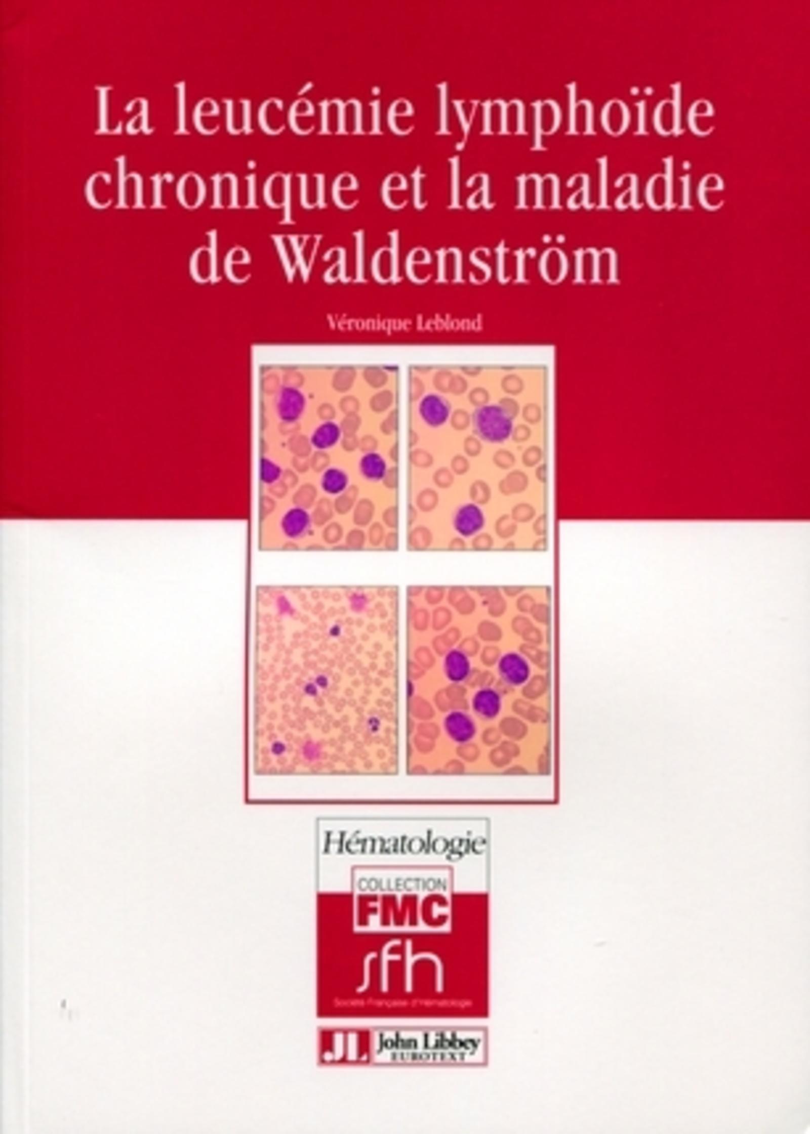 LA LEUCEMIE LYMPHOIDE CHRONIQUE ET LA MALADIE DE WALDENSTROM