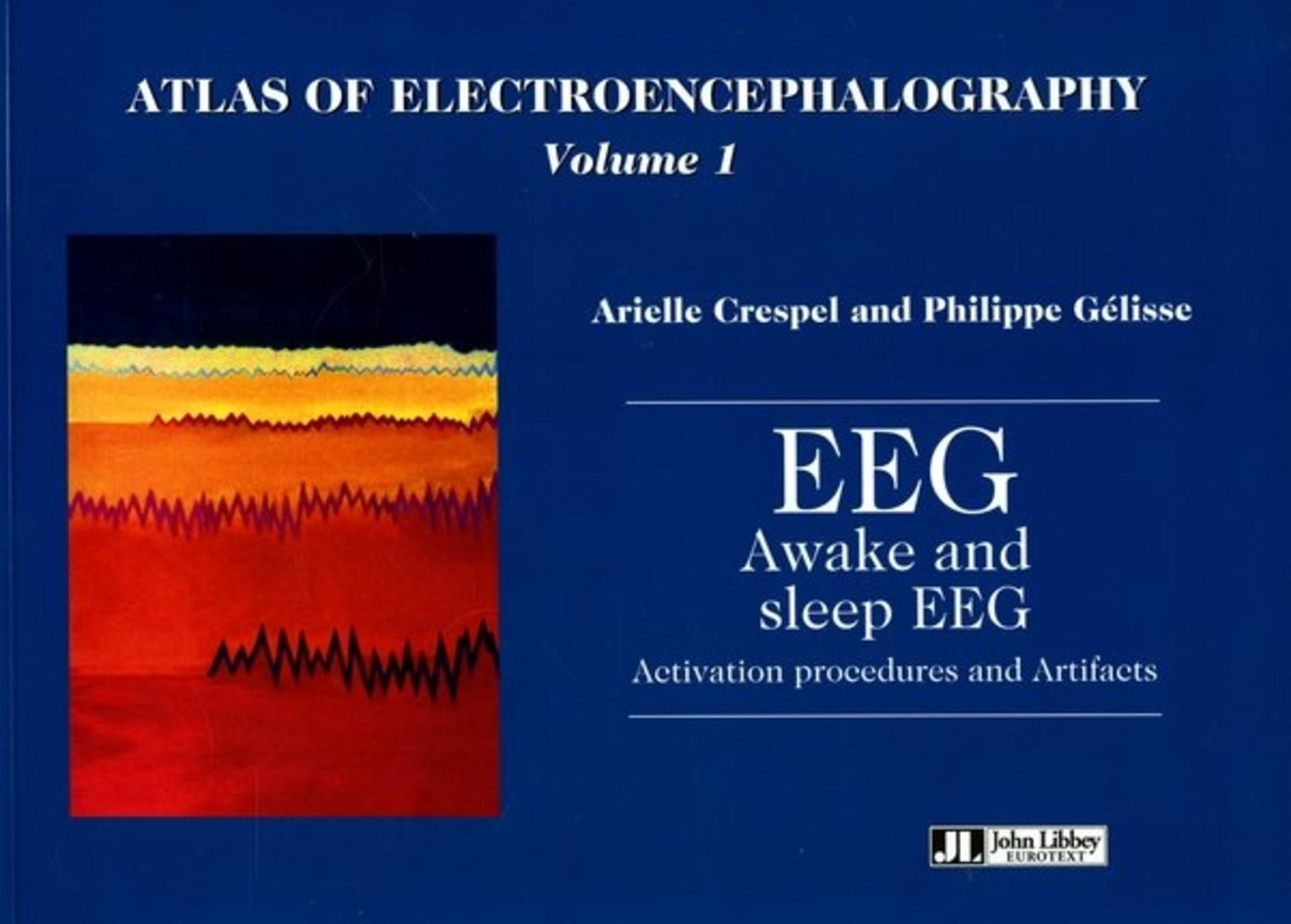 Awake and sleep EEG activation procedures and artifacts
